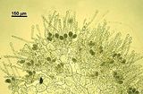 Leathesia mucosa var. condensata3